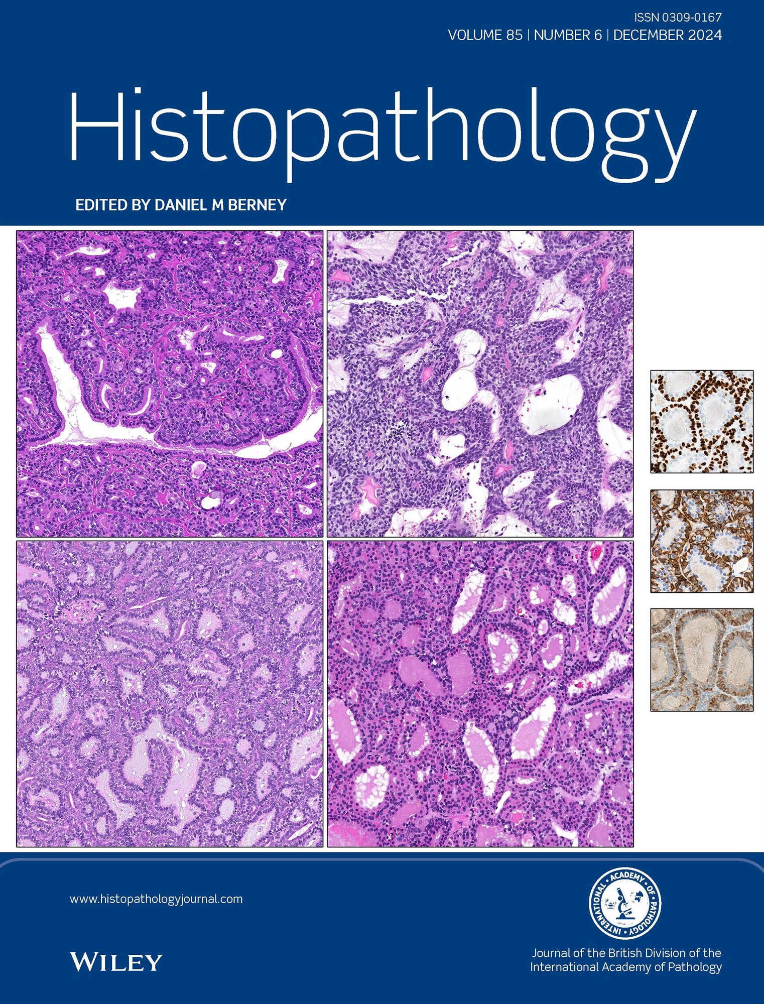 Histopathology Latest Journal Issue: Now Available image